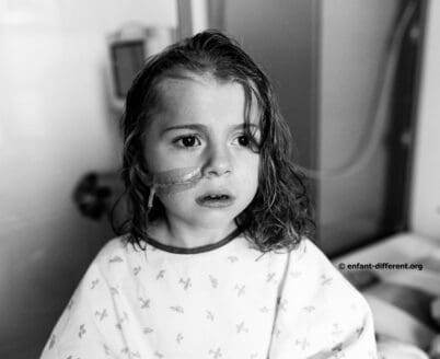 Gastrostomie : le regard photographique d’une maman